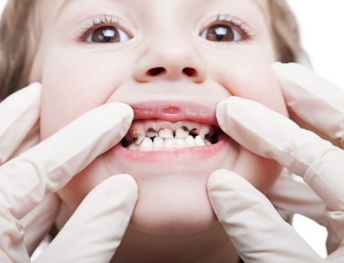 دندان کودک - کلنیک دندانپزشکی مریم
