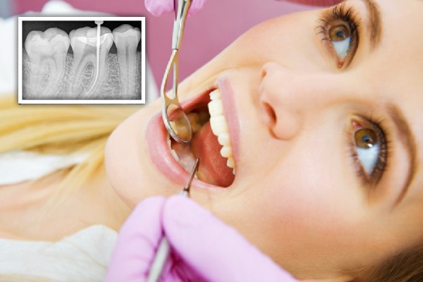 مراجعه به موقع به دندانپزشک - کلینیک مریم