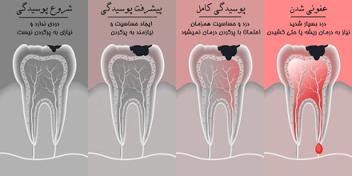 جراحی دندان - کلینیک مریم