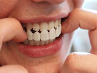 پروتز دندان- کلینیک دندانپزشکی مریم